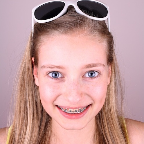 Young Girls With Braces On Teeth